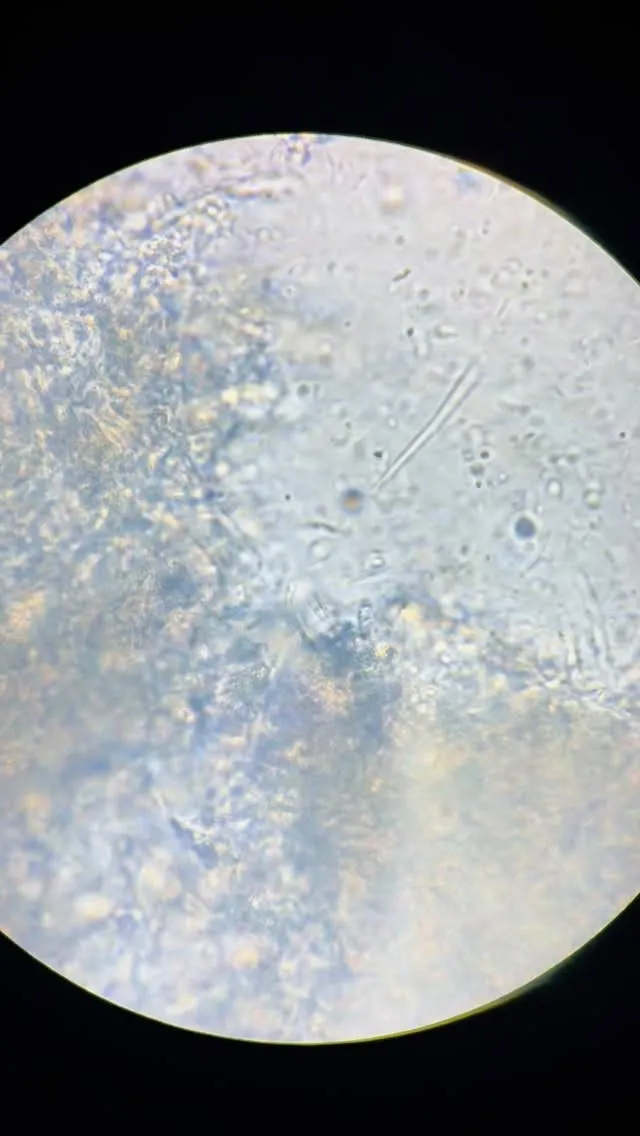 うごめく菌…🦠